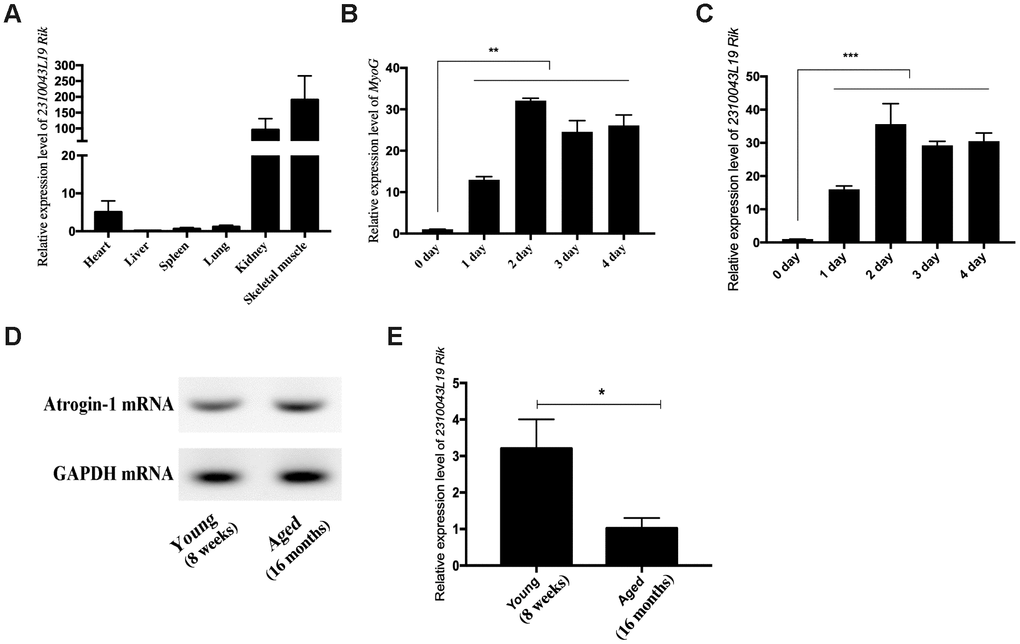 Expression pattern of lncRNA 2310043L19Rik. (A) Real-time PCR analysis of lncRNA 2310043L19Rik expression in 6 types of mouse tissues. Mean values ± SEM, n=3, *PPB) Real-time PCR analysis of MyoG expression in C2C12 during 4 days of differentiation. (C) Real-time PCR analysis of lncRNA 2310043L19Rik expression in C2C12 during 4 days of differentiation. Mean ±SEM, n=3. (D) Semi-quantitative RT-PCR analysis of mRNA expression of Atrogin-1, the muscle atrophy marker gene marker, in the tibialis anterior muscle of young (8 weeks) and aged (16 months). (E) Real-time PCR analysis of lncRNA 2310043L19Rik expression in young mouse (8 weeks) and aged (16 months) mice in the tibialis anterior muscle. Mean values ± SEM, n=3, *PPP