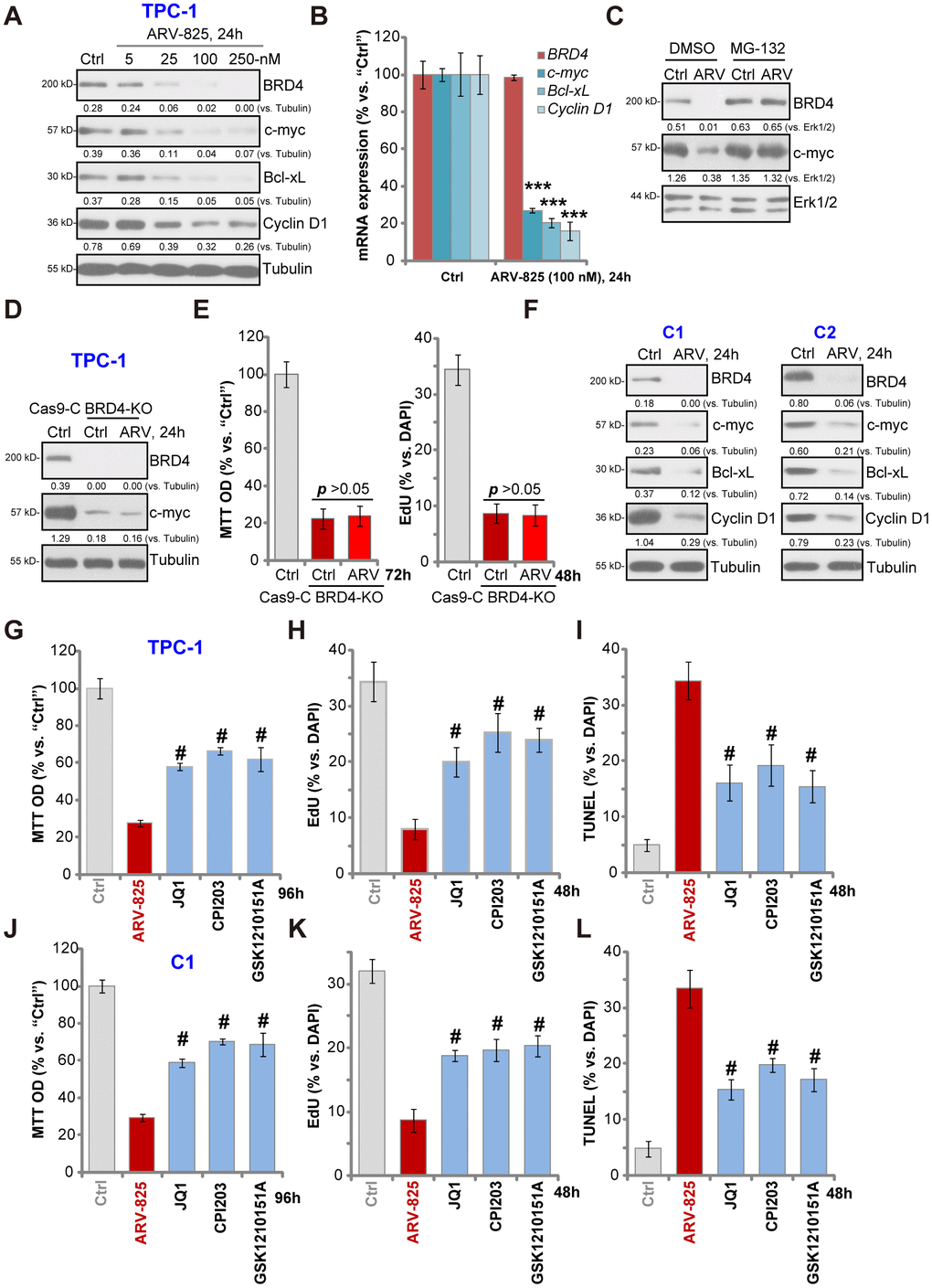 ARV-825 inhibits BRD4 signaling in human thyroid carcinoma cells. TPC-1 cells (A and B) or the primary human thyroid carcinoma cells (“C1”/“C2”) (F) were treated with applied concentration of ARV-825 for 24h, tested by Western blotting and qPCR assays of listed genes. TPC-1 cells were pre-treated with MG-132 (25 μM) for 2h, followed by ARV-825 (100 nM) treated for 24h, expression of listed proteins was shown (C). The stable TPC-1 cells with CRISPR/Cas9 BRD4-KO construct (“BRD4-KO”) cells were treated with or without ARV-825 (100 nM, for indicated time periods), control TPC-1 cells with empty vector (“Cas9-C”) were left untreated; expression of listed proteins was shown (D); Cell viability and proliferation were tested by MTT and EdU staining assays (E), respectively. TPC-1 cells or “C1” human thyroid carcinoma cells were treated with ARV-825 (100 nM), JQ1 (500 nM), CPI203 (500 nM) or GSK1210151A (500 nM) for indicated time periods, cell viability (MTT assay, 96h) (G and J), proliferation (testing nuclear EdU/DAPI ratio, 48h) (H and K) and apoptosis (nuclear TUNEL ratio, 48h) (I and L) were tested, and results were quantified. Expression of listed proteins was quantified and normalized to the corresponding loading control (A, C, D and F). #p vs. “ARV-825” treatment group (G–L). The experiments were repeated three times, and similar results obtained.