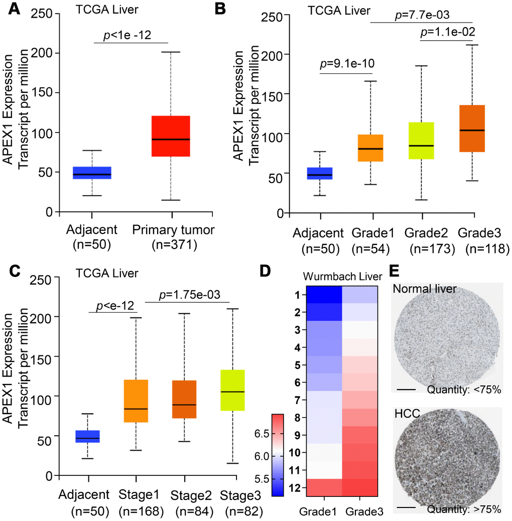 APEX1 mRNA and protein expression correlates with HCC tumor grades. (A) APEX1 mRNA levels in 371 HCC and 50 normal liver tissues from the TCGA database are shown. (B) The histogram plot shows APEX1 mRNA expression in grades 1-4 HCC patients. As shown, APEX1 mRNA expression is incrementally upregulated with increasing tumor grades. (C) The histogram plot shows APEX1 mRNA expression levels in stages 1-4 HCC patients. As shown, APEX1 mRNA levels show incremental upregulation with increasing tumor stages. (D) The heat map shows APEX1 mRNA levels in grade 1 and 3 HCC patients in the Wurmbach Liver dataset from the Oncomine database. (E) Representative images show APEX1 protein expression in HCC and adjacent normal liver tissues that were obtained from The Human Protein Atlas database. The APEX protein expression was analyzed by immunohistochemistry. The scale bar is 200μm.