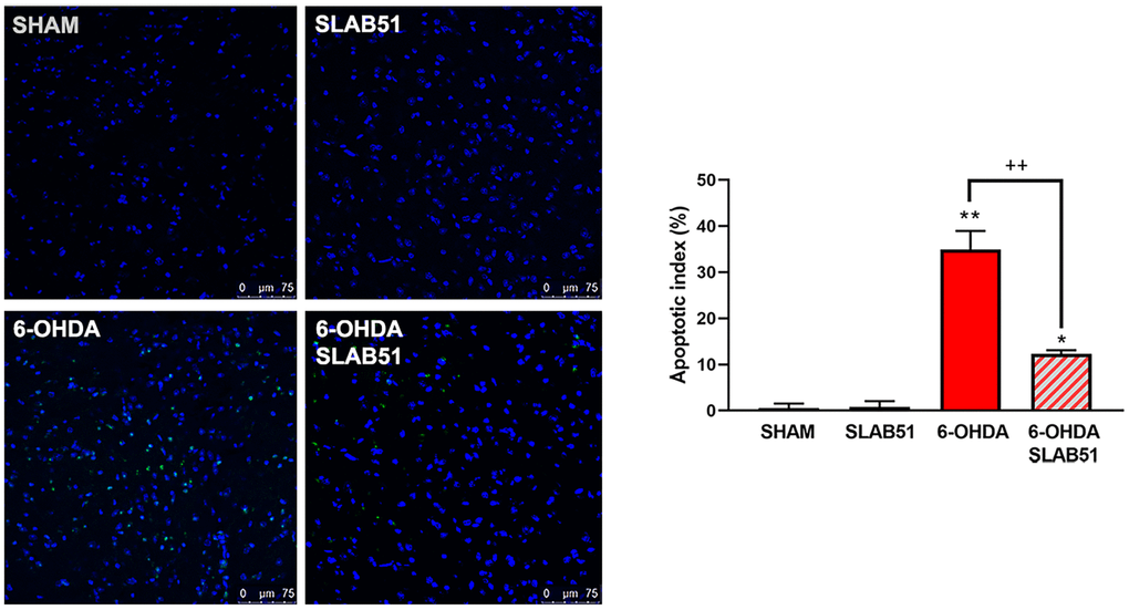 TUNEL assays in mice substantia nigra. Figures were taken at confocal microscope at 40x magnification. The graph shows apoptotic index obtained by counting positive nuclei. * p