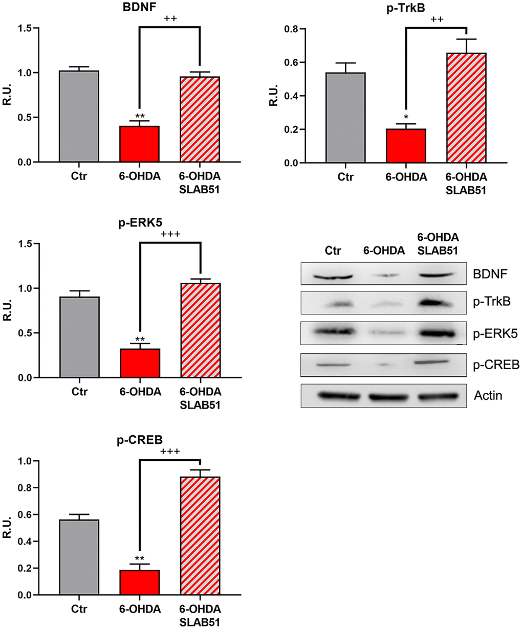 WB and relative densitometric analysis for Ctr, 6-OHDA and 6-OHDA+SLAB51 for mBDNF, p-TrkB, p-ERK5, p-CREB. Results are mean ± SE of 3 different experiments (n=3). *p