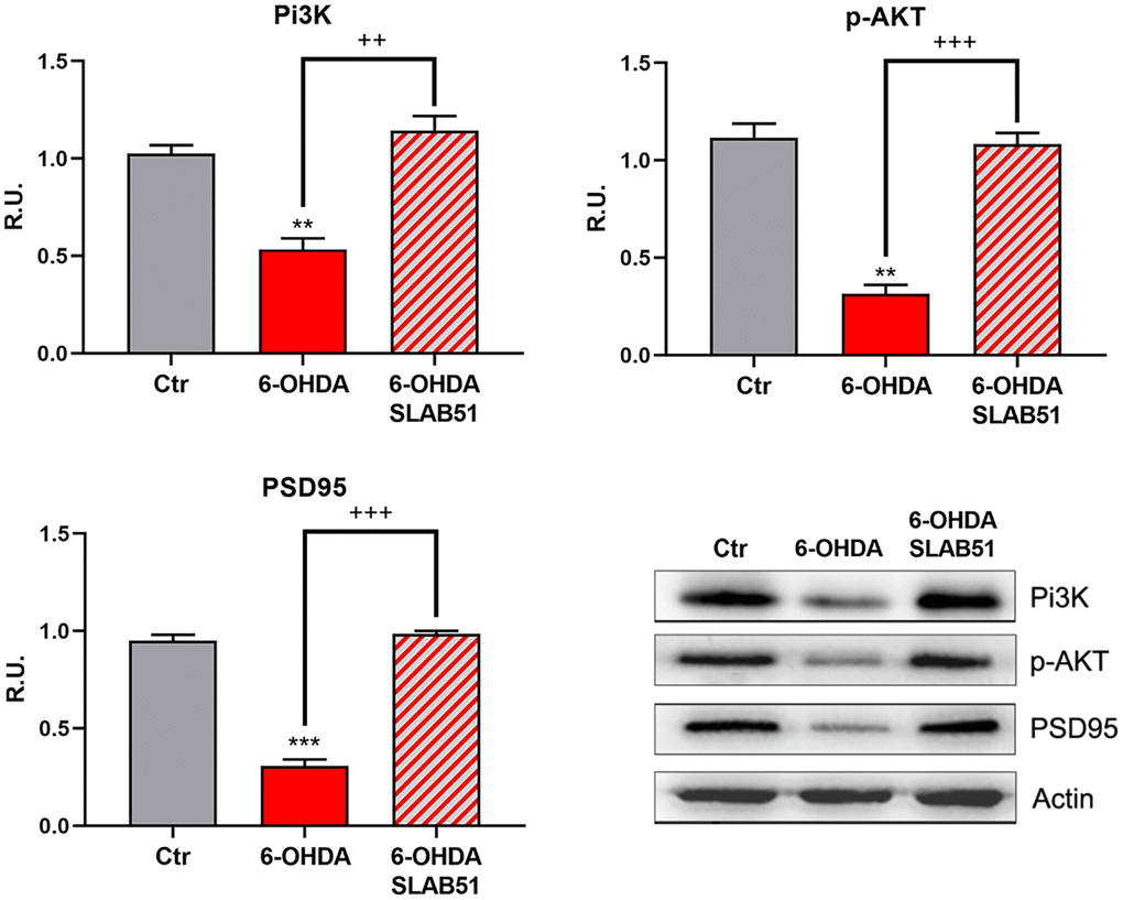 WB and relative densitometric analysis for Ctr, 6-OHDA and 6-OHDA+SLAB51 for PI3K, p-Akt, and PSD95. Results are mean ± SE of 3 different experiments (n=3). ** p