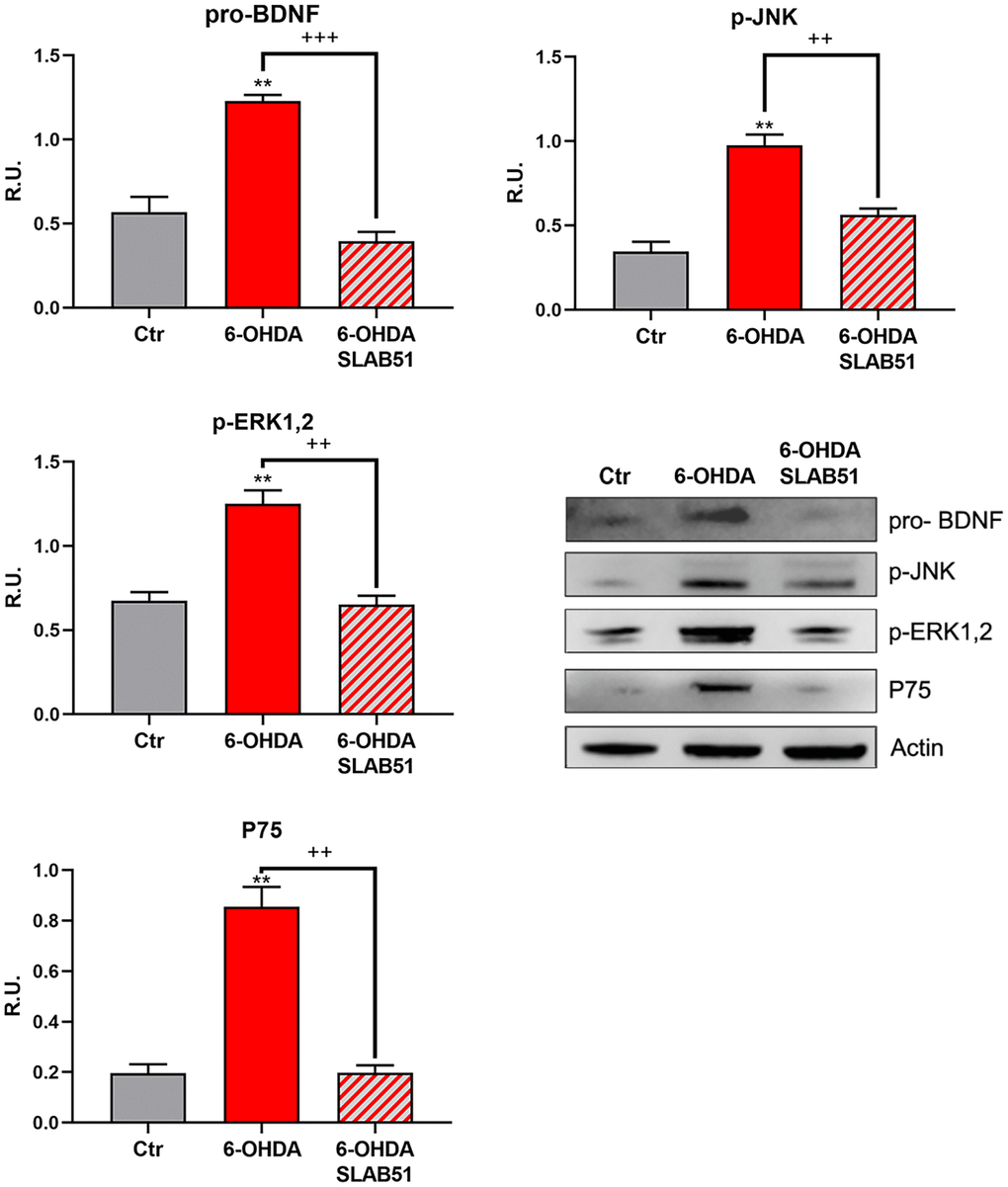 WB and relative densitometric analysis for Ctr, 6-OHDA and 6-OHDA+SLAB51 for pro-BDNF, p-JNK, p-ERK1,2 and P75. Results are mean ± SE of 3 different experiments (n=3). ** p