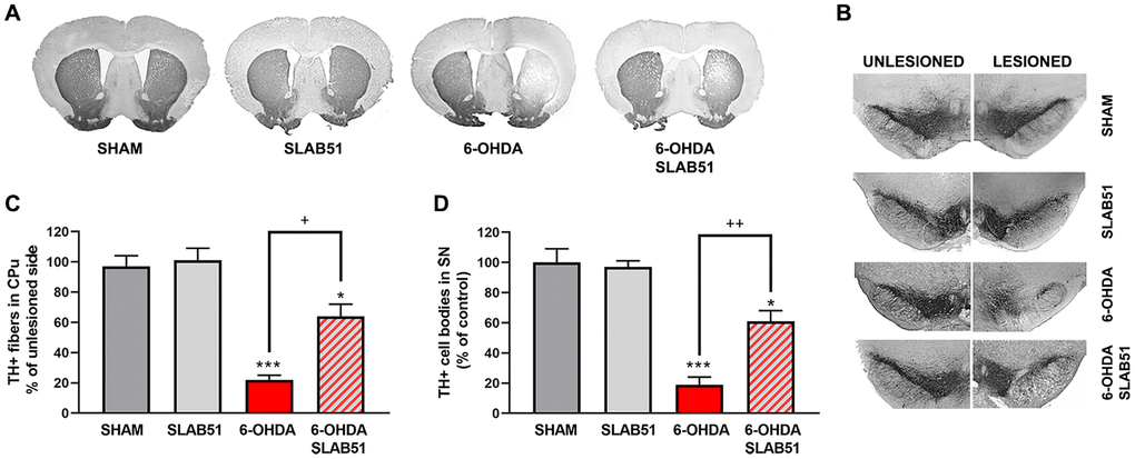 Immunostaining of TH in dopaminergic neurons. Transverse section taken through the substantia nigra pars compacta (SNc) and the ventral tegmental area (VTA), immunostained for TH to evaluate the dopaminergic-induced injury by stereotaxic injection of 6-OHDA in the right side. Histograms shows the percentage of TH+ fibers loss in striatum (CPu) and TH+ cell bodies in substantia nigra (SN) (expressed in percentage of unlesioned side). * p