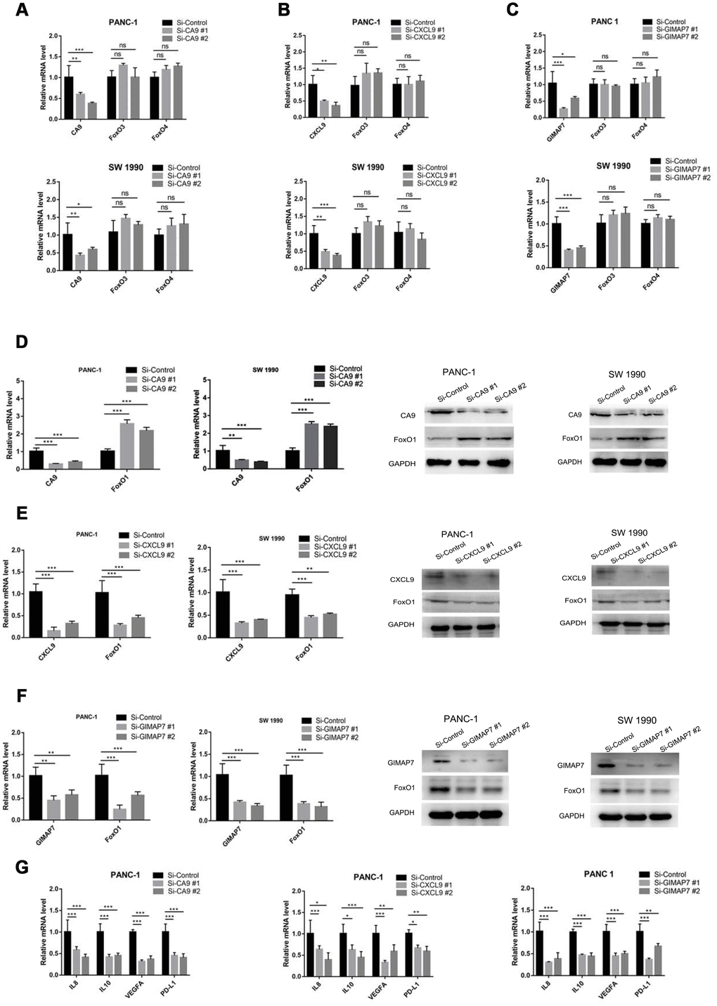 CA9, CXCL9, and GIMAP7 regulate the expression level of FOXO1 in PAAD. PANC-1 and SW 1990 cells were transfected with indicated siRNA. Then, 24 hrs post-transfection, cells were harvested for RT-qPCR. The data shown were the mean values ± SD from three replicates. *, P A–C) PANC-1 and SW 1990 cells transfected with Si-CA9 (A), Si-CXCL9 (B) and Si-GIMAP7 (C) were harvested for RT-qPCR. (D–F) PANC-1 and SW 1990 cells transfected with Si-CA9 (D), Si-CXCL9 (E) and Si-GIMAP7 (F) were harvested for RT-qPCR and western blotting. (G) PANC-1 cells transfected with Si-CA9 (C), Si-CXCL9 (E), or Si-GIMAP7 (G) were harvested for RT-qPCR.