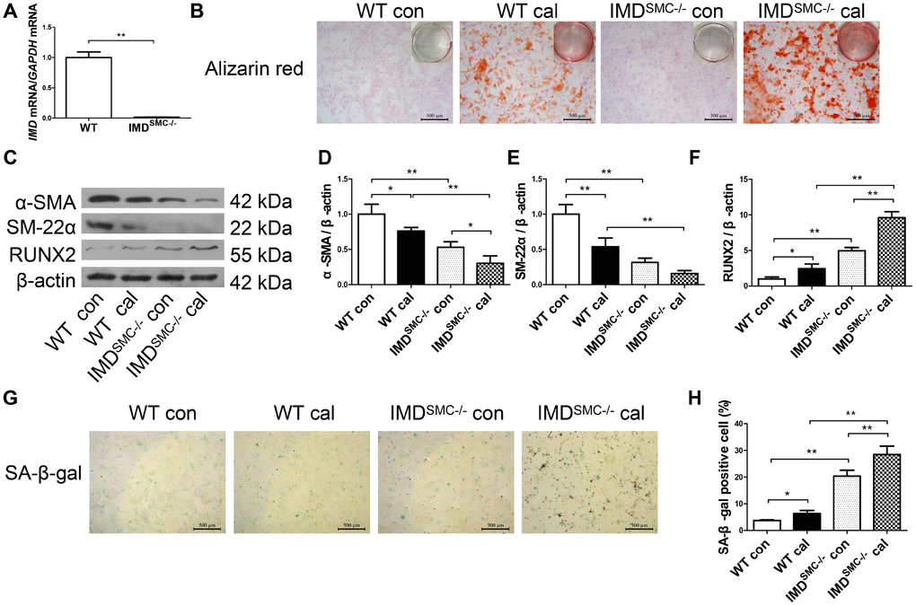 Deficiency of IMD promoted senescence and calcification in VSMCs in vitro. (A) RT-PCR analysis of mRNA level of IMD in VSMCs from WT and IMDSMC-/- mice (n=3). (B) Alizarin red staining (positive staining: red) (scale bar=500 μm) of mice VSMCs (passage 5-6). (C) Western blot analysis of protein levels of α-SMA, SM-22α and RUNX2, and (D–F) quantification (n=3). (G) SA-β-gal staining (blue) (scale bar=500 μm) and (H) quantification of β-galactosidase-positive staining (n=6). WT=wild type. IMDSMC-/-=VSMC-specific IMD-deficient. Con=control. Cal= calcification. Data are mean ± SD. *PP