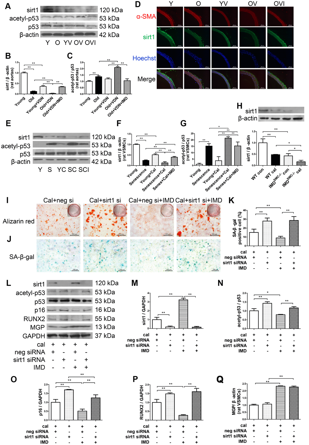 IMD1-53 inhibited aging-associated vascular calcification by increasing sirt1 expression and deacetylase activity. (A) Western blot analysis of protein levels of sirt1, acetylation p53 (acetyl-p53), and total p53 (p53) in rat aortas, and (B, C) quantification (n=3). (D) Immunofluorescence staining for α-SMA (red) and sirt1 (green) in rat aortas. Nuclei were stained with Hoechst 33342 (blue). Merged images (α-SMA, sirt1 and nuclei) are shown (Scale bar=200 μm). (E) Western blot analysis of protein levels of sirt1, acetyl-p53, and p53 in rat VSMCs and (F, G) quantification (n=3). (H) Western blot analysis and quantification of protein level of sirt1 in WT and IMDSMC-/- mouse VSMCs (n=3). (I) Alizarin red staining (red) (Scale bar=500 μm) and (J) SA-β-gal staining (blue) (Scale bar=100 μm) of calcified-rat senescent VSMCs treated with IMD1-53 plus sirt1 siRNA or negative siRNA, and (K) quantification of β-galactosidase-positive staining (n=6). (L) Western blot analysis of protein levels of sirt1, acetyl-p53, p53, p16, RUNX2 and MGP and (M–Q) quantification (n=3). For in vivo experiments, Y=young rats; O=old rats; YV=young+VDN; OV=old+VDN; OVI=old+VDN+IMD1-53. For in vitro experiments, Y=young VSMCs; S=senescent VSMCs; YC=young+calcification; SC=senescence+calcification; SCI=senescence+calcification+IMD1-53. WT=wild type. IMDSMC-/-=VSMC-specific IMD-deficient. Con=control. Cal= calcification. neg si=negative siRNA. sirt1 si=sirt1 siRNA. Cal=calcification. Data are mean ± SD. *PP