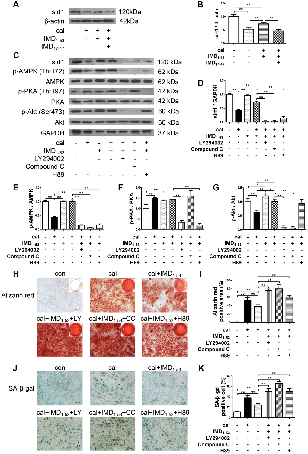 Involvement of signaling pathways in IMD1-53 upregulating sirt1 in senescence-associated VSMC calcification. (A) Western blot analysis of IMD17-47 (10-6 mol/L) blocking the effect of IMD1–53 on sirt1 protein level in calcified-rat senescent VSMCs, and (B) quantification (n=3). (C) Western blot analysis of protein levels of sirt1, phosphorylated-AMP-activated protein kinase (p-AMPK) (Thr172), AMPK, phosphorylated-protein kinase A (p-PKA) (Thr197), PKA, phosphorylated-protein kinase B (p-Akt) (Ser473), Akt in rat senescent VSMCs preincubation with or without phosphatidylinositol 3-kinase (PI3K) inhibitor LY294002, AMPK inhibitor Compound C or PKA inhibitor H89 (all 10 μmol/L) before IMD1–53 administration and calcification induction, and (D–G) quantification of (D) sirt1 (n=3), (E) p-AMPK/AMPK (n=3), (F) p-PKA/PKA (n=3), (G) p-Akt/Akt (n=3). (H) Alizarin red staining (Scale bar=200 μm), and (I) quantification of calcium deposition-positive staining (red) (n=6). (J) SA-β-gal staining (Scale bar=100 μm), and (K) quantification of β-galactosidase-positive staining (blue) (n=6). Con=control. Cal=calcification. Data are mean ± SD. *PP