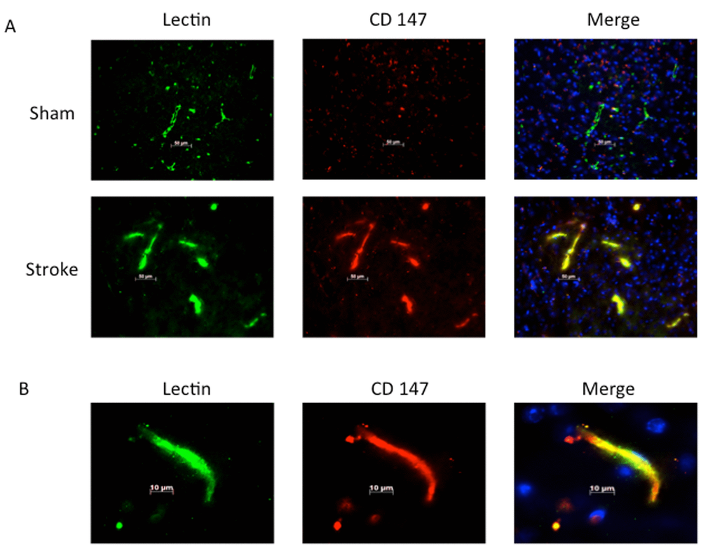 Lectin positive endothelial cells co-localize with CD147. (A) Representative 20x IHC images of sham and stroke brain slices indicating CD147 co-localizes with lectin positive endothelial cells. Pearson’s correlation coefficient B) 63x high magnification image of lectin with co-localization with CD 147 in stroke brain.