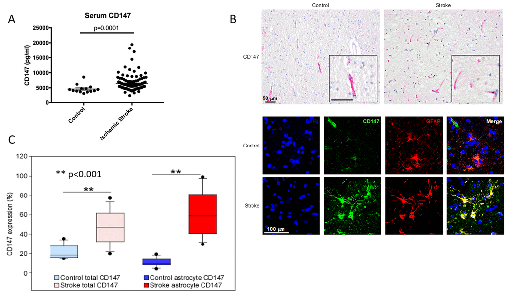 CD147 is expressed on human astrocytes and levels of CD147 correlate with poor outcomes. (A) Serum levels of human CD147 24 hours post stroke. (B) Representative immunohistochemical staining patterns of CD147 in human brain tissues from age-matched control and ischemic stroke subjects (Top, scale bar = 50 μm). Immunofluorescence (IF) staining in human brain tissues (Bottom, scale bar = 100 μm). Simple IF with DAPI (blue), CD147 (green), and GFAP (red). Double IF with CD147 (green) and GFAP (red). (C) Quantification of levels of CD147 and GFAP expressing CD147 in human brain tissue.