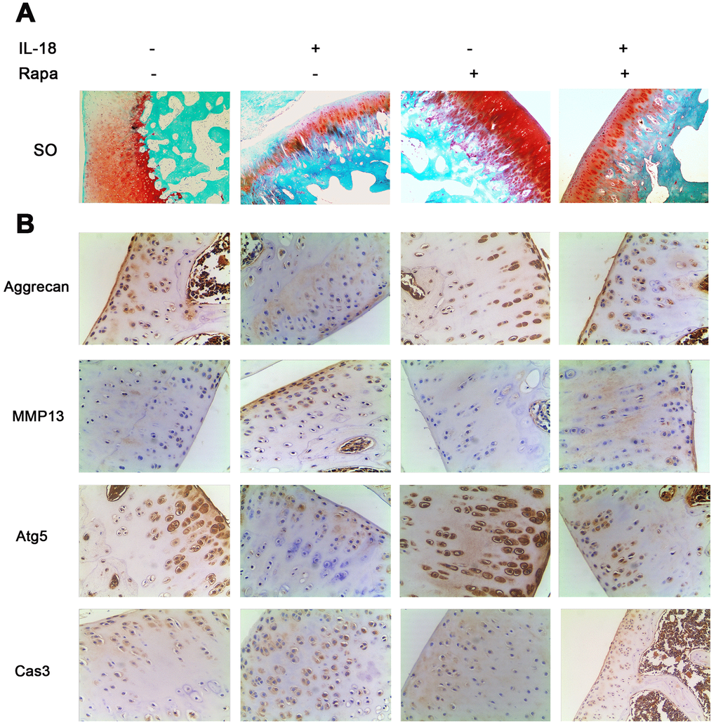 Rapamycin showed a cartilage-protective role in a rat model. A total of 60 SD rats were randomly divided into four groups: 15 rats in the IL-18 treatment group which received 50 μl IL-18 solution (100 ng/ml); 15 rats in the rapamycin treatment group which received 50 μl rapamycin solution (100 nM); 15 rats in the IL-18 + rapamycin treatment group which received 50 μl IL-18 + rapamycin solution (100 ng/ml and 100 nM respectively); 15 rats in the control group which received an equal volume of vehicle. (A) Rats were euthanized after 8 weeks of treatment, and the knees were preserved in 4% paraformaldehyde solution. 4% paraformaldehyde-fixed knees were decalcified and embedded in paraffin, then sectioned at 5 μm thickness. Sections of the interior joint were stained with safranin O-fast green (SO). (B) Aggrecan, MMP13, Atg5, and Caspase3 were detected by immunohistochemistry.