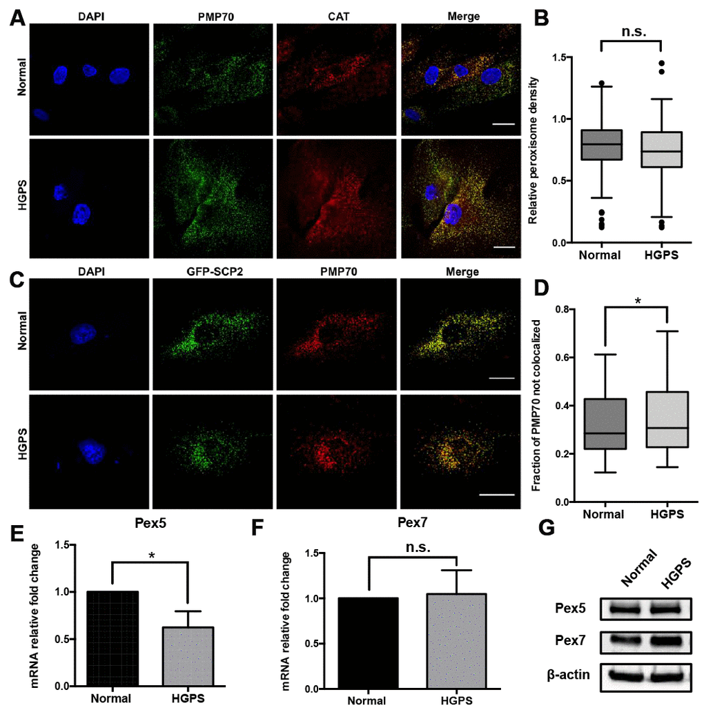 Characterization of the peroxisomes in HGPS fibroblasts. (A) Peroxisomes localization indicated by PMP70 and catalase immunofluorescence staining in HGPS patient-derived dermal fibroblasts and its normal counterpart. Bar = 25μm. (B) The peroxisomes density per cell was indicated by the quantification of PMP70 puncta per square unit in normal and HGPS fibroblast cells. More than 100 cells from 3 independent experiments were analyzed and the data was represented in Tukey box plot. Boxes show the 25th, 50th, and 75th percentiles and the dots indicate the outliers. (C) Confocal fluorescence microscopy analysis of normal and HGPS fibroblasts transfected with GFP-SCP2, and probed with PMP70 antibody. Bar = 25μm. (D) Box plot of the portion of PMP70 puncta not colocalized with SCP2 (peroxisomal ghosts) in each cell. More than 100 cells from 3 independent experiments were analyzed. Boxes show the 25th, 50th, and 75th percentiles. Kolmogorov-Smirnov test was used to compare the distributions of these two samples. (E, F) Quantitative RT-PCR analysis of the relative expression of Pex5 and Pex7 in normal and HGPS fibroblasts. (G) Western blot analysis of Pex5 and Pex7 in normal and HGPS fibroblasts at passage 21. All experiments were performed using mid-passage cells between p15 to p25. All experiments were repeated at least three times and representative data were shown as indicated. *, p 