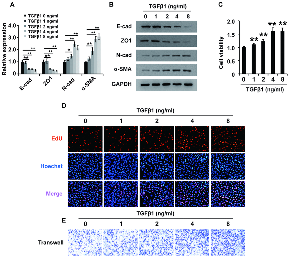 TGF-β1 induces fibrosis in HK2 cells. (A) qPCR analyses of E-cadherin (E-cad), ZO1, N-cadherin (N-cad) and α-SMA expression in HK2 cells treated with TGF-β1 at different concentrations for approximately 48 h. (B) Western blot analyses of E-cad, ZO1, N-cadherin and α-SMA expression in HK2 cells treated with TGF-β1 at different concentrations for approximately 48 h. GAPDH was used as a control. (C–E) CCK-8, EdU and cell migration analyses (transwell) of the viability, proliferation and migration of HK2 cells treated with TGF-β1 at different concentrations for approximately 48 h. *P  0.01.