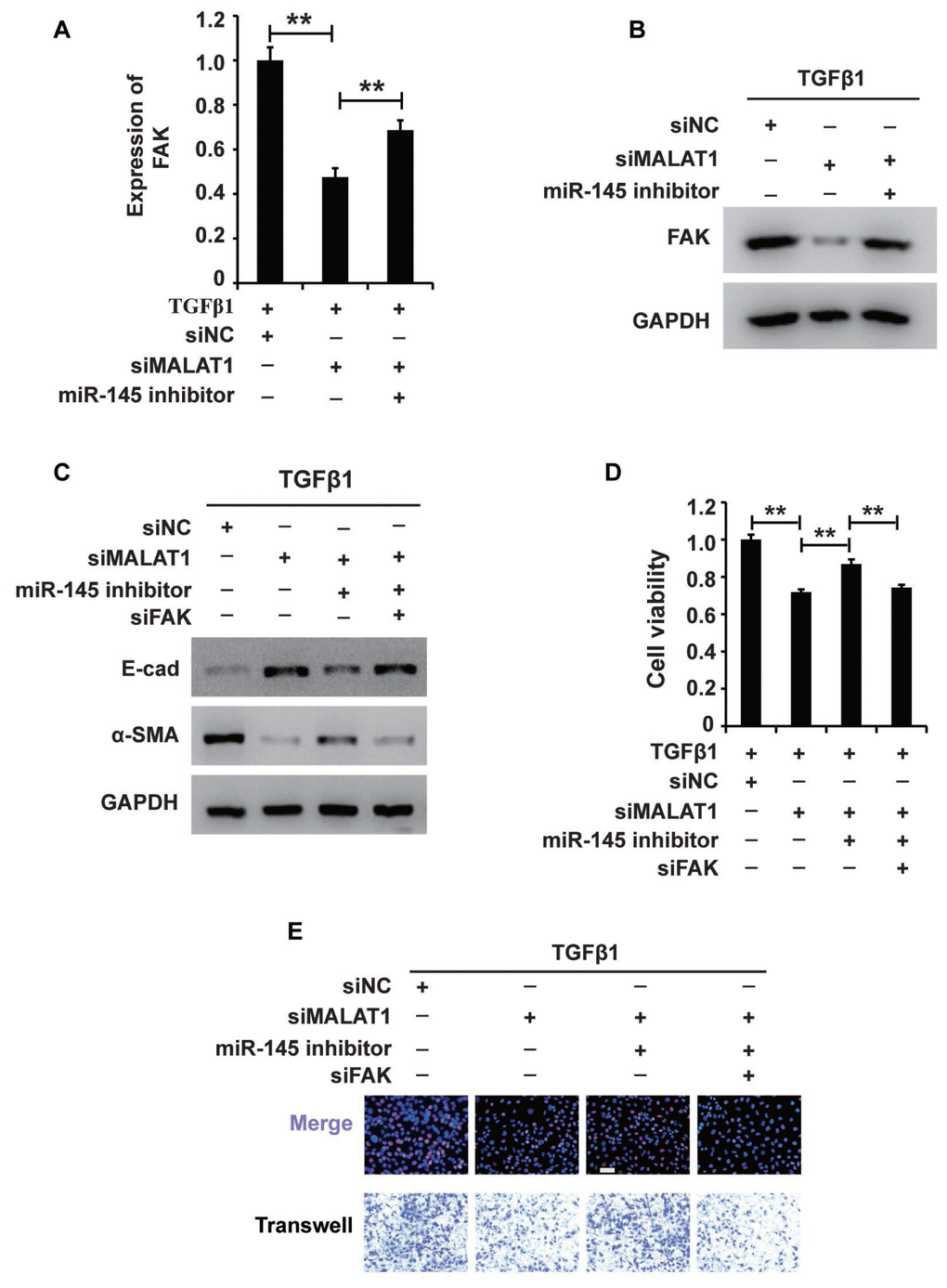 MALAT1 regulates the MALAT1/miR-145/FAK axis in HK2 cells treated with TGF-β1. (A and B) qRT-PCR and western blot analyses of FAK expression in HK2 cells treated with TGF-β1 alone or together with siMALAT1, a miR-145 inhibitor or a NC. (C) Western blot analyses of E-cadherin, vimentin, α-SMA and collagen I expression in HK2 cells receiving different treatments. (D and E) CCK8, EdU and cell migration analyses of the viability, proliferation and migration of HK2 cells receiving different treatments. GAPDH was used as a control. *P P 