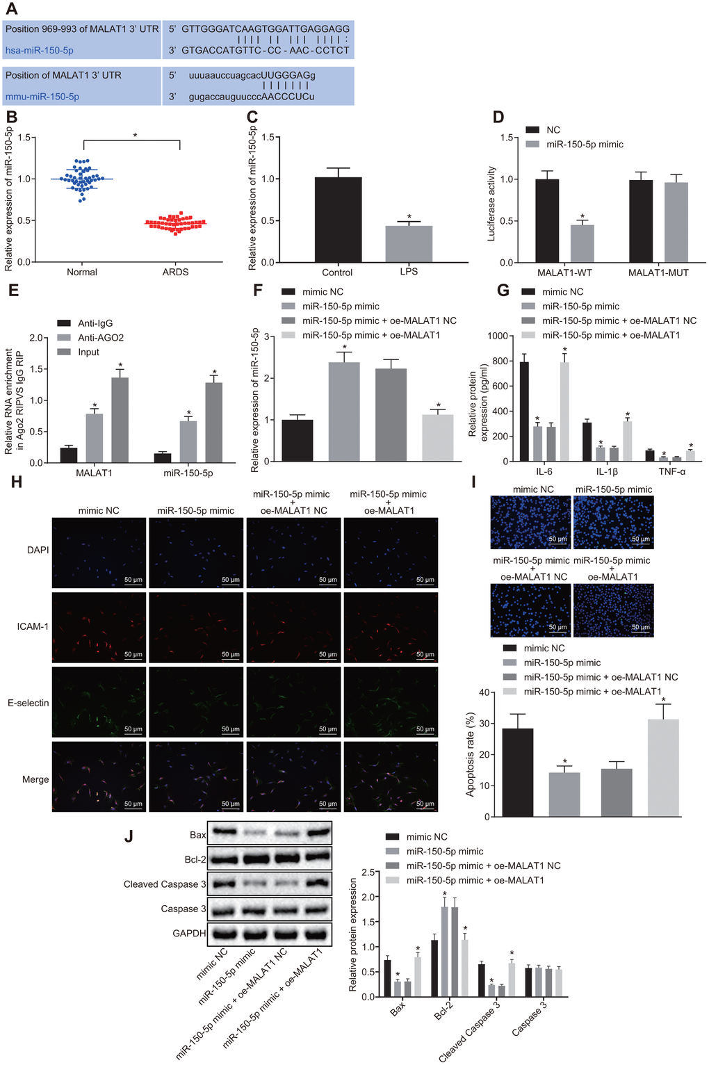 Overexpression of miR-150-5p downregulates MALAT1 expression to suppress apoptosis of HPMECs and decrease the expression of pro-inflammatory cytokines and adhesion factors. (A) The binding site between MALAT1 and miR-150-5p predicted by the starBase website; (B) The expression of miR-150-5p in peripheral blood samples of healthy controls (n = 46) and patients with ARDS (n = 46), as determined by RT-qPCR. * p vs. peripheral blood samples of healthy controls. (C) Expression of miR-150-5p in normal and LPS-treated HPMECs determined by RT-qPCR. * p vs. the control cells. (D) Luciferase activity of MALAT1-WT and MALAT1-MUT. * p vs. cells transfected with NC. (E) The binding of MALAT1 and miR-150-5p and the binding of MALAT1 and AGO2, as analyzed using RIP assay. * p vs. IgG. (F) Expression of miR-150-5p in HPMECs transfected with miR-150-5p mimic or miR-150-5p mimic + oe-MALAT1 determined by RT-qPCR. (G) Expression of pro-inflammatory cytokines (IL-6, IL-1β and TNF-α) in HPMECs transfected with miR-150-5p mimic or miR-150-5p mimic + oe-MALAT1 determined by ELISA. (H) Expression of endothelial cell adhesion molecules (E-selectin and ICAM-1) in HPMECs transfected with miR-150-5p mimic or miR-150-5p mimic + oe-MALAT1 detected by immunofluorescence (× 200). (I) HPMEC apoptosis upon transfection with miR-150-5p mimic or miR-150-5p mimic + oe-MALAT1 detected by TUNEL assay (× 200). (J) Expression of Bcl-2, Bax, cleaved caspase 3 and Caspase3 in HPMECs transfected with miR-150-5p mimic or miR-150-5p mimic + oe-MALAT1 detected by Western blot analysis. * p vs. cells transfected with miR-150-5p mimic NC or miR-150-5p mimic + oe-MALAT1 NC. The data were measurement data and expressed as mean ± standard deviation. The data between two groups were compared using unpaired t-test and those among multiple groups were analyzed by one-way ANOVA, with Tukey's post hoc test. The cell experiment was repeated three times independently.
