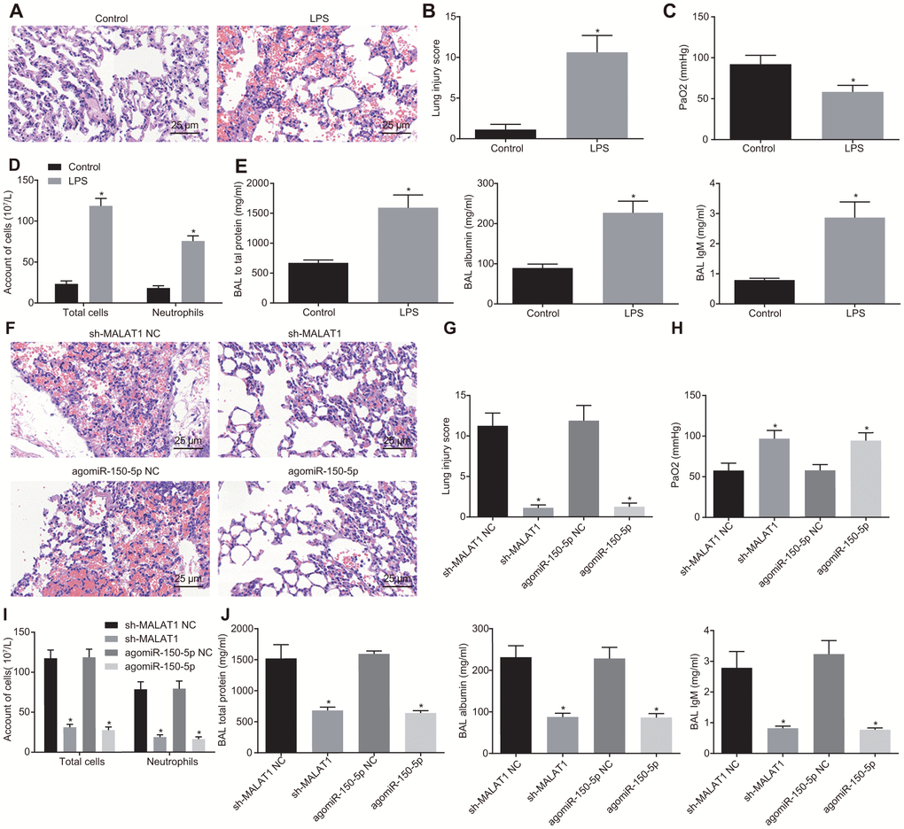 Downregulated MALAT1 or upregulated miR-150-5p alleviates lung injury. (A) HE staining (× 400) of lung tissues from healthy control and ARDS mice. * p vs. healthy control mice. (B) Lung tissue injury score of healthy control and ARDS mice. * p vs. healthy control mice. (C) PaO2 of healthy control and ARDS mice. * p vs. healthy control mice. (D) The number of total cells, neutrophils, and macrophages in BAL of healthy control and ARDS mice. * p vs. healthy control mice. (E) The concentration of total protein, albumin, and IgM in BAL of healthy control and ARDS mice. (F) HE staining analysis of lung tissues of ARDS mice after injection with different lentiviruses (× 400). (G) Lung tissue injury score of ARDS mice after injection with different lentiviruses. (H) PaO2 in arterial blood of ARDS mice after injection with different lentiviruses. (I) The number of total cells, neutrophils and macrophages in BAL of ARDS mice. (J) The concentration of total protein, albumin, and IgM in BAL of ARDS mice after injection with different lentiviruses. * p vs. cells transfected with sh-MALAT1 NC or agomiR-150-5p NC. The data were measurement data and expressed as mean ± standard deviation. The data between two groups were analyzed by unpaired t-test. n = 8 for mice following each treatment.