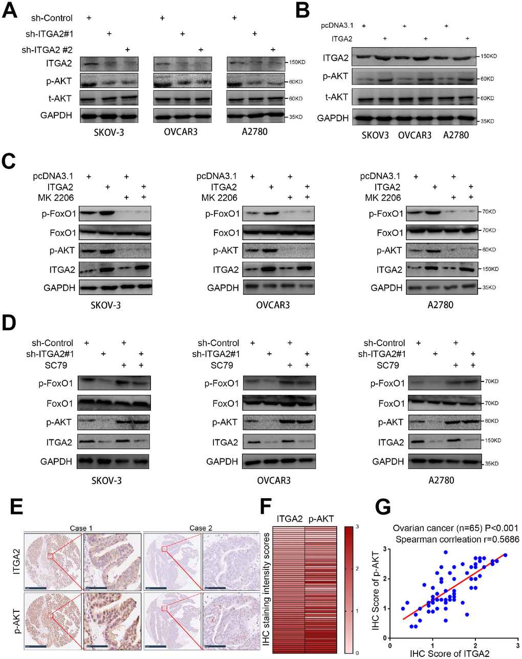 ITGA2 contributes to activating AKT pathway in ovarian cancer cells. (A) SKOV3, OVCAR3, and A2780 cells lines were infected with sh-Control, sh-ITGA2 #1, or sh-ITGA2 #2. Western blot analysis was performed with these cells after 72 hours culturing. GAPDH served as an internal reference. (B) SKOV3, OVCAR3, and A2780 cells lines were infected with or without ITGA2 plasmids. Western blot analysis was performed with these cells after 72 hours culturing. GAPDH served as an internal reference. (C) SKOV3, OVCAR3, and A2780 cells lines were infected with or without ITGA2 plasmids and were treated with or without AKT inhibitor (MK 2206). Western blot analysis was performed with these cells after 72 hours culturing. GAPDH served as an internal reference. (D) SKOV3, OVCAR3, and A2780 cells lines were infected with sh-Control, sh-ITGA2 #1, or sh-ITGA2 #2 and were treated with or without AKT agonist (SC79). Western blot analysis was performed with these cells after 72 hours culturing. GAPDH served as an internal reference. (E) IHC Images of ITGA2 and p-AKT staining using TMA tissue sections (n = 65 ovarian cancer patient specimens). The scale bars were shown as indicated. f and g. Heatmap (F) and dot plot (G) to show the correlation of IHC scores for the expression of the ITGA2 and p-AKT proteins in ovarian cancer patient specimens. (r = 0.5686 for spearman correlation coefficients, P 