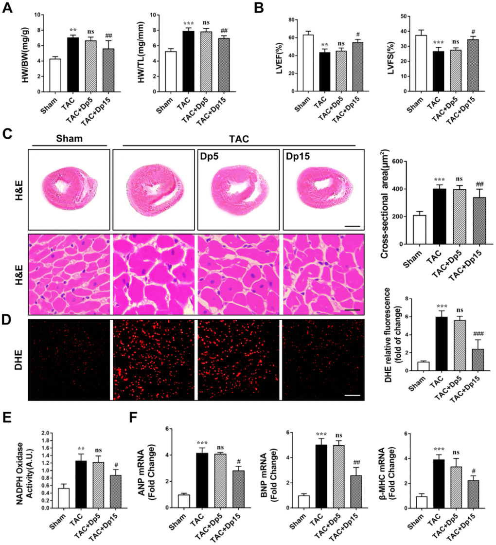 Delphinidin attenuated cardiac hypertrophy and improved cardiac function induced by pressure overload in vivo. (A) Statistical differences in the heart weight/body weight (HW/BW) and heart weight/tibia length (HW/TL) ratios between sham and TAC mice treated with vehicle or delphinidin (n=8). (B) Echocardiographic parameters in sham and TAC mice treated with vehicle or delphinidin (n=8). (C) Left, Hematoxylin-eosin (H&E) staining was performed to assess hypertrophic growth of the hearts of sham and TAC mice treated with vehicle or delphinidin (n=8). Right, Statistical analysis of differences in cardiomyocyte size (n=8). (D) Quantitative dihydroethidium (DHE) staining (n=8). (E) Chemiluminescence lucigenin assay (n=8). (F) Quantitative real-time PCR (qRT-PCR) was performed to analyze the mRNA levels of hypertrophic genes (n=5). In A–E, **pppppA–E, **p versus the sham group; ***p versus the sham group; ns versus the TAC group; #p versus the TAC group; ##p versus the TAC group; ###p versus the TAC group.