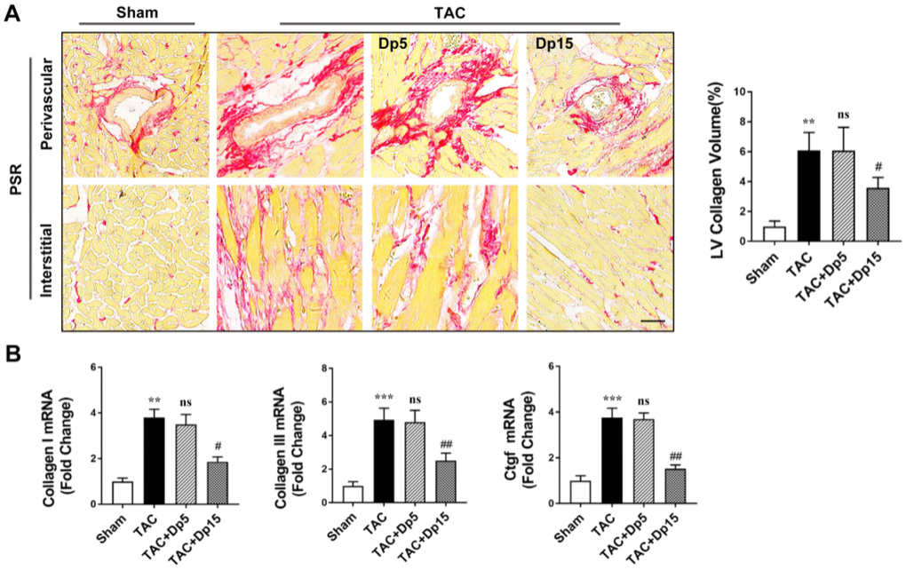 Delphinidin attenuated pressure overload-induced myocardial fibrosis in vivo. (A) Left, Representative PSR staining of histological sections of the LV (n=8). Right, Statistical analysis of differences in cardiac fibrosis. (B) Quantitative real-time PCR (qRT-PCR) was performed to analyze the mRNA levels of fibrosis genes (n=5). In A–B, **p versus the sham group; ***p versus the sham group; ns versus the TAC group; ##p versus the TAC group; ###p versus the TAC group.