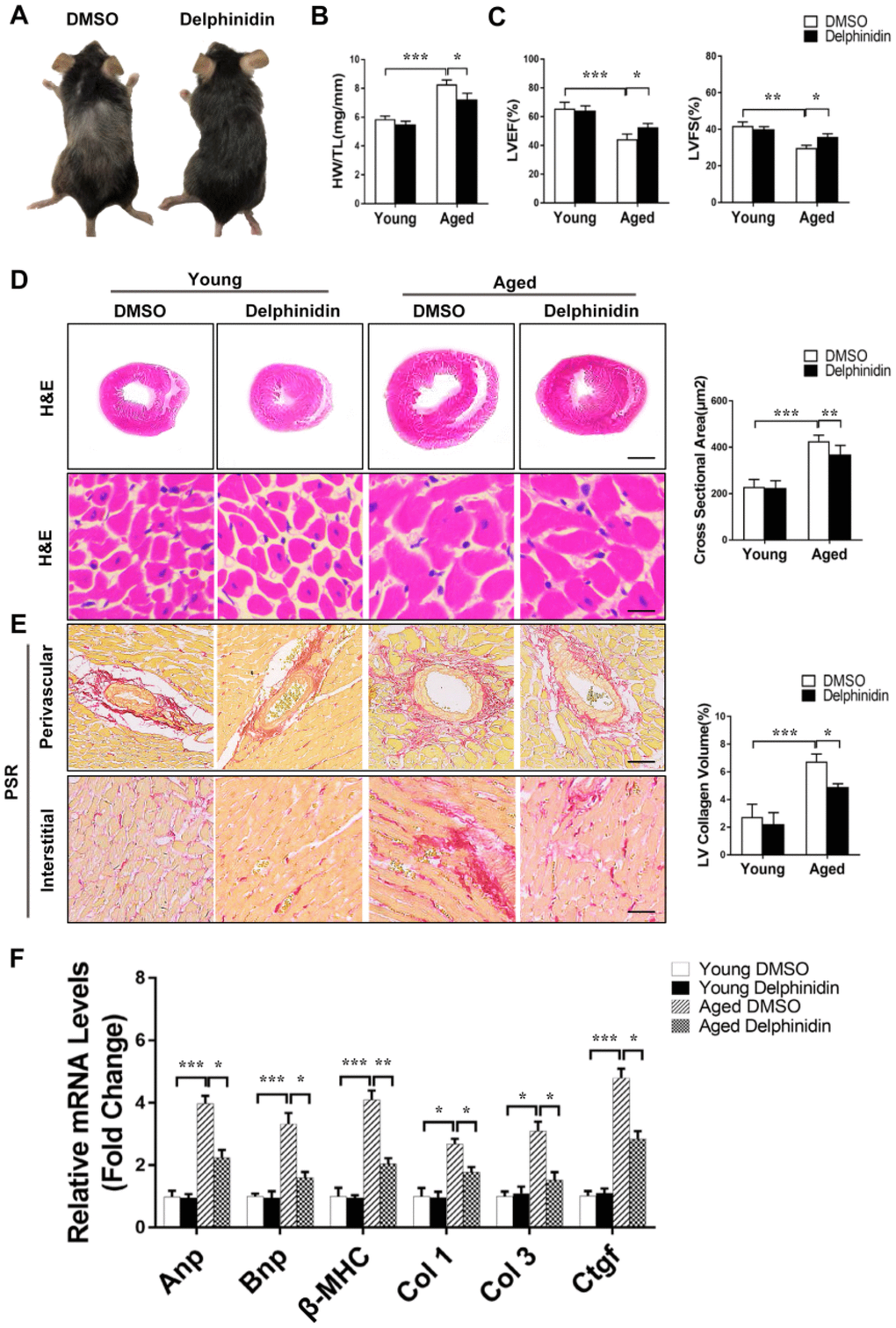 Delphinidin reduced cardiac hypertrophy in aged mice. (A) Representative gross morphology of young and aged mice administered delphinidin and DMSO. (B) Statistical analysis of differences in the heart weight/tibia length (HW/TL) ratio (n=6). (C) Left ventricular ejection fraction and fractional shortening of young and aged mice administered delphinidin and DMSO (n=6). (D) Left, H&E staining was performed to assess hypertrophic growth of the hearts of young and aged mice administered with delphinidin and DMSO. Right, Statistical analysis of differences in cardiomyocyte size (n=6). (E) Left, Representative PSR staining of histological sections of the LV (n=6). Right, Statistical analysis of differences in cardiac fibrosis. (F) Quantitative real-time PCR (qRT-PCR) was performed to analyze the mRNA levels of hypertrophic genes and fibrosis genes (n=5). In B–F, *p, **p, ***p.