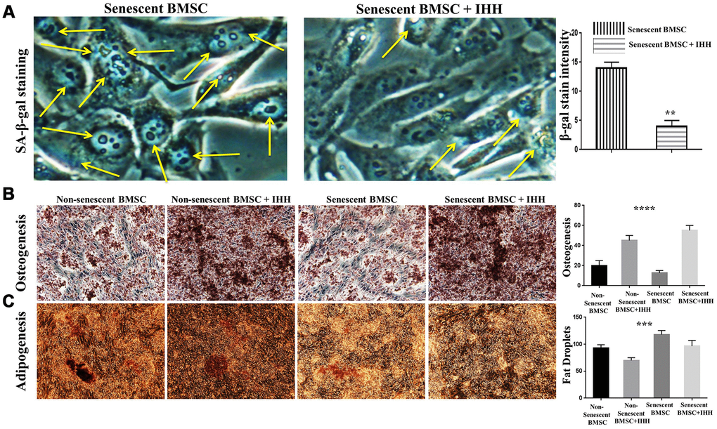 IHH alleviated senescence and induced proper differentiation in BMSC. (A) Senescent BMSC (n=5) incubated with and without IHH for 24 hrs, then stained by SA-β-gal stain. (B) Non-senescent and senescent BMSC (n = 5) were incubated in osteogenic differentiation medium with and without IHH for 21 days. Osteogenesis measured using Alizarine-Red-S stain. (C) Non-senescent and senescent BMSC (n = 5) were incubated in adipogenesis differentiation medium with and without IHH for 21 days. Adipogenesis measured by staining fat droplets using Oil-Red-O stain. All data obtained are indicated as mean ± SEM. **P 