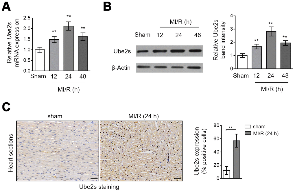 Ube2s expression is upregulated after MI/R injury. (A) qRT-PCR analysis of the mRNA level of Ube2s in the heart from C57BL/6 mice following 12 h, 24 h and 48 h of MI/R injury. Samples from mice receiving sham surgery were used as controls. Each group includes 8 mice. The results were normalized to β-Actin and expressed as relative to sham group. Data are mean ± SD. Data were compared with sham group using one-way ANOVA analysis. **, P B) Western blotting analysis of the protein level of Ube2s in the heart as described in (A). β-Actin was used as a loading control. The representative band images are presented (left). The analysis of the relative band intensity is also presented (right). Data are mean ± SD. Data were compared with sham group using one-way ANOVA analysis. **, P C) Immunohistochemistry analysis of Ube2s expression in the heart from mice subjected to sham or MI/R injury for 24 h as descried in (A). The representative images are shown (left). The analysis of percentage of positive stained cells is also depicted (right). Scale bar, 50 μm. Data are mean ± SD. Data were compared with sham group using Student’s t-test. **, P 