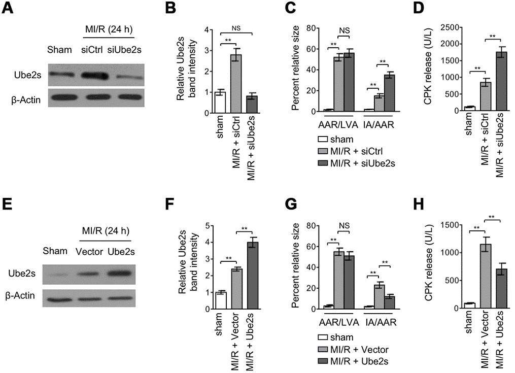 Ube2s acts to protect against MI/R injury. (A–B) C57BL/6 mice were intra-myocardially transfected with control siRNA (siCtrl) or Ube2s siRNA (siUbe2s) 48 h prior to MI/R surgery. Following 24 h of reperfusion, the protein level of Ube2s in the heart was analyzed by Western blotting. Samples from sham group were used as controls. Each group includes 8 mice. β-Actin was used as a loading control. The representative band images (A) and relative band intensity analysis (B) are presented. Data are mean ± SD. Data were compared with sham group using Student’s t-test. **, P C) Heart samples were harvested as described in (A), and the mid-myocardial cross sections were prepared. The infarct size in the heart sections was quantified, and the results of percentage of size are shown. AAR/LVA, ratio of area at risk (AAR) to left ventricular area (LVA); IA/AAR, ratio of infarct area (IA) to AAR. Data are mean ± SD. Data were compared using Student’s t-test. **, P D) C57BL/6 mice were treated as in (A). The samples of serum were collected and the level of creatine phosphokinase (CPK) was quantified. Data are mean ± SD. Data were compared using Student’s t-test. **, P E, F) C57BL/6 mice were intra-myocardially infected with lentivirus expressing vector control or Ube2s 48 h prior to MI/R surgery. Following 24 h of reperfusion, the protein level of Ube2s in the heart was analyzed by Western blotting. Samples from sham group were used as controls. Each group includes 8 mice. β-Actin was used as a loading control. The representative band images (E) and relative band intensity analysis (F) are presented. Data are mean ± SD. Data were compared using Student’s t-test. **, P G) Heart samples were harvested as described in (E), and the mid-myocardial cross sections were prepared. The infarct size in the heart sections was quantified, and the results of percentage of size are shown. AAR/LVA, ratio of area at risk (AAR) to left ventricular area (LVA); IA/AAR, ratio of infarct area (IA) to AAR. Data are mean ± SD. Data were compared using Student’s t-test. **, P H) C57BL/6 mice were treated as in (E). The samples of serum were collected and the level of creatine phosphokinase (CPK) was quantified. Data are mean ± SD. Data were compared using Student’s t-test. **, P 