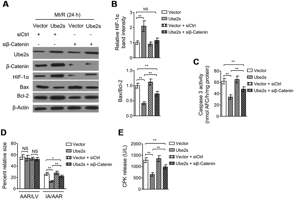 β-Catenin knockdown abrogates Ube2s-augmented HIF-1α activation and diminishes Ube2s protective effect on MI/R injury. (A–B) C57BL/6 mice were intra-myocardially infected with lentivirus expressing vector control or Ube2s in combination with the transfection with control siRNA (siCtrl) or β-Catenin siRNA (siβ-Catenin) 48 h prior to MI/R surgery. Following 24 h of reperfusion, the protein expression of targets as indicated in the heart was analyzed by Western blotting. Each group includes 8 mice. β-Actin was used as a loading control. The representative band images (A) and relative band intensity analysis (B) are presented. Data are mean ± SD. Data were compared using Student’s t-test. **, P C) Heart samples were harvested as described in (A). The supernatants of the homogenized heart samples were collected, and the caspase-3 activity was determined. The results are expressed as nmol AFC/h/mg protein. Data are mean ± SD. Data were compared using Student’s t-test. **, P D) Heart samples were harvested as described in (A), and the mid-myocardial cross sections were prepared. The infarct size in the heart sections was quantified, and the results of percentage of size are shown. AAR/LVA, ratio of area at risk (AAR) to left ventricular area (LVA); IA/AAR, ratio of infarct area (IA) to AAR. Data are mean ± SD. Data were compared using Student’s t-test. **, P E) C57BL/6 mice were treated as in (A). The samples of serum were collected and the level of creatine phosphokinase (CPK) was quantified. Data are mean ± SD. Data were compared using Student’s t-test. **, P 
