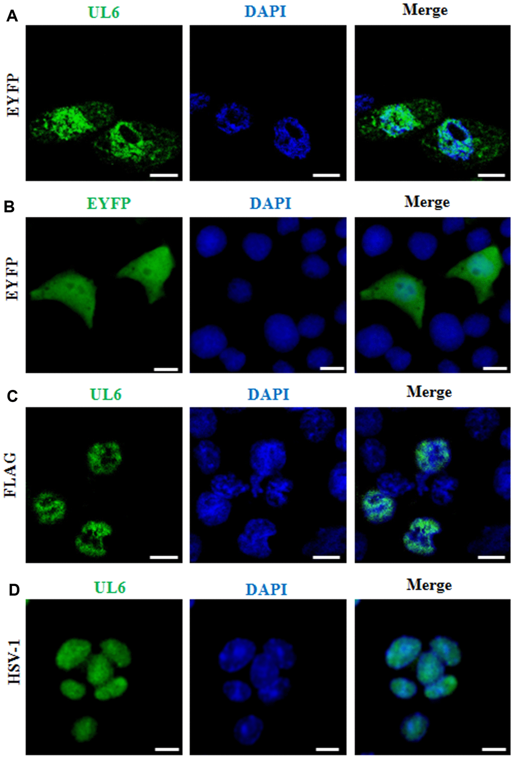 Subcellular distribution of UL6 in plasmid-transfected and HSV-1-infected cells. Subcellular distribution of EYFP-UL6 (A), EYFP (B) and FLAG-UL6 (C) in related plasmid transfected COS-7 cells. (D) Subcellular distribution of UL6 in HSV-1 infected Vero cells. Vero cells were infected with HSV-1 (F strain) at an MOI of 1. 8 h post-infection, Vero cells were fixed with 4% paraformaldehyde, permeabilized with 0.5% Triton X-100, and incubated with the anti-UL6 pAb. Then, cells were incubated with FITC-conjugated goat anti-rabbit IgG (green) and stained with DAPI (blue) to visualize the nuclei. EYFP fusion proteins were shown in pseudocolor green. The image shown represents a great proportion of the cells with homogeneous subcellular distribution. All scale bars indicate 10 um. Statistical analysis of the fluorescence was shown in Table 1.