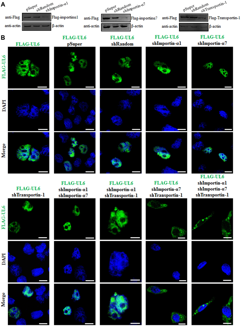 Subcellular distribution of UL6 in presence of different shRNA expression plasmids. (A) Verification of knock down efficiency of the constructed shRNA expression plasmids for importin α1, importin α7 and transportin-1. HEK293T cells were co-transfected with the plasmids combination of Flag-kα2 (importin α1)/pSuper, Flag-kα2/shRandom, Flag-kα2/shImportin-α1, Flag-kα6 (importin α7)/pSuper, Flag-kα6/shRandom, Flag-kα6/shImportin-α7, pFLAG-CMV-transportin-1/pSuper, pFLAG-CMV-transportin-1/shRandom or pFLAG-CMV-transportin-1/shTransportin-1 for 24 h. Then, cells were lysed and IB was performed with anti-Flag mAb. β-actin was used as a loading control. (B) One or two or three plasmids of shImportin-α1, shImportin-α7 and shTransportin-1 were co-transfected with pFLAG-UL6 into COS-7 cells for 24 h, then IFA was carried out using confocal fluorescence microscopy. Statistical analysis of the fluorescence was shown in Table 4.