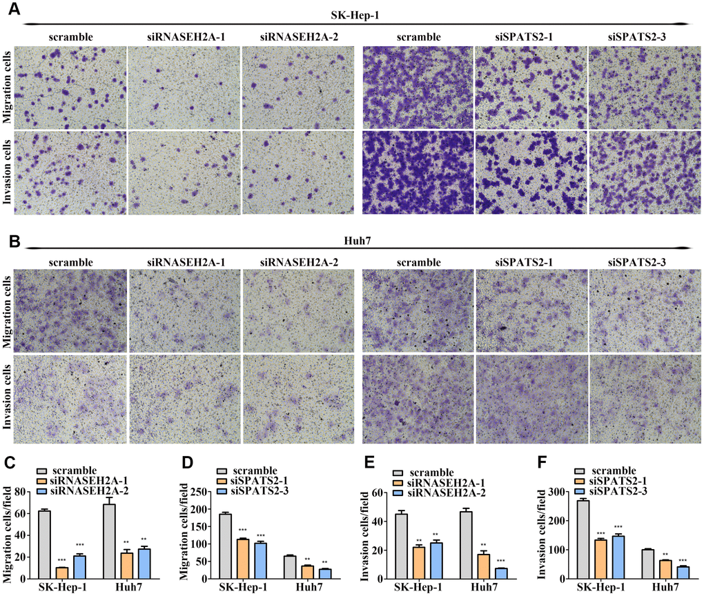RNASEH2A and SPATS2 promotes HCC cell migration and invasion. (A–B) HCC cell migration and invasion were detected after downregulating the expression of RNASEH2A or SPATS2 by Transwell and Boyden assays. (C–F) Statistical analysis of Transwell and Boyden assay results. *P P P 