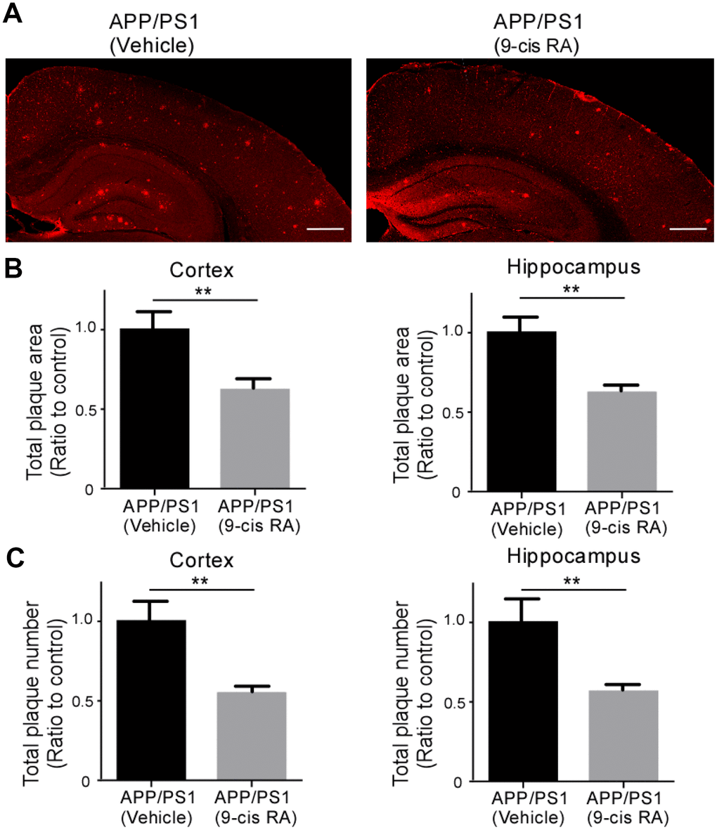 Treatment with 9-cis RA reduced the level of Αβ deposition in APP/PS1 mice compared with vehicle-treated control mice. (A) Representative images of Αβ staining in the frontal cortex and hippocampus of APP/PS1 mice treated with vehicle as a control (left) or 9-cis RA (right). Scale bars, 500 μm. (B) Stereological quantification of the Αβ volume in the cortex (left) and hippocampus (right). (C) Stereological quantification of the Αβ numbers in the cortex (left) and hippocampus (right). Values from multiple images of each section that cover most of the region of study were averaged per animal per experiment. Data represent the mean ± SEM (n=6). **, p