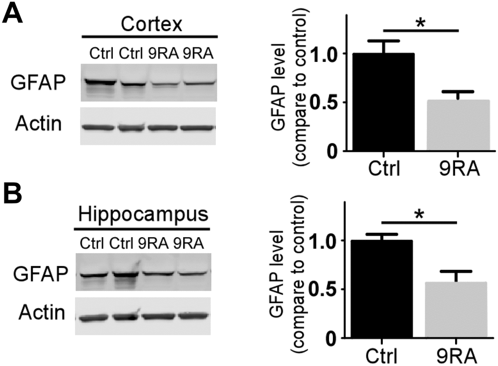 9-cis RA reduced Αβ-associated gliosis. (A, B) The levels of GFAP in the cortex (n=4/group) and hippocampus (n=4/group) were examined by western blotting. Data represent the mean ± SEM. *, p