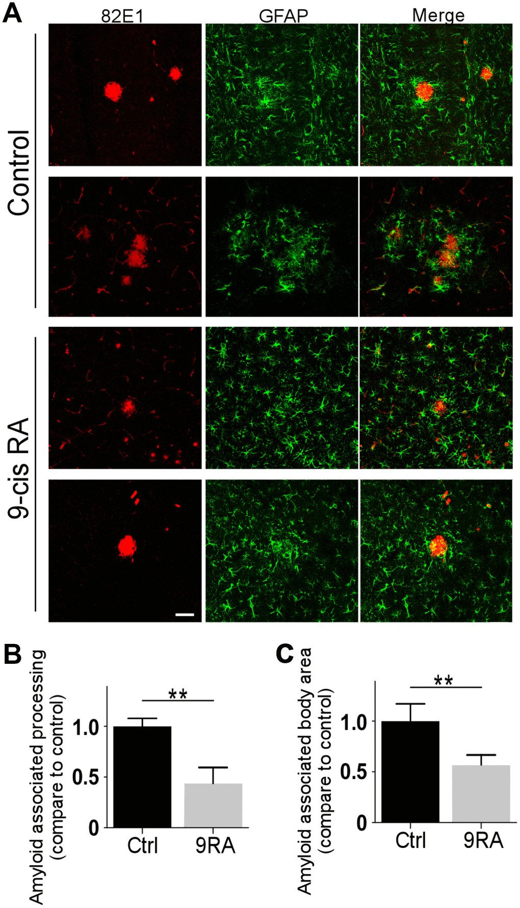 9-cis RA suppressed the activation of astrocytes in APP/PS1 mice. (A) Representative images of GFAP and 82E1 immunochemistry in coronal sections from 7-month-old APP/PS1 animals treated with 9-cis RA (bottom) or vehicle (upper). (B) Quantification of amyloid-associated astrocyte processes compared with the Ctrl (vehicle). (C) Quantification of amyloid-associated astrocyte bodies compared with the Ctrl (vehicle). Scale bars, 50 μm. Data represent the mean ± SEM (n=6). **, p