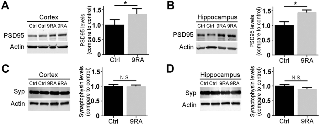 9-cis RA rescued amyloid-associated synaptic loss. The levels of the postsynaptic marker PSD-95 (A, B) and presynaptic marker synaptophysin (Syp) (C, D) in the cortex (left) and hippocampus (right) were examined by western blotting. Data represent the mean ± SEM (n=4). *, p