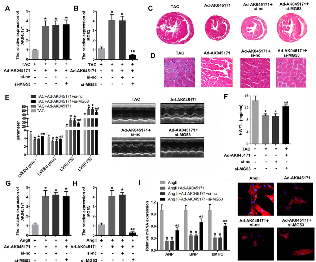 MG53 knockdown reversed the effect of AK045171 on cardiac hypertrophy. (C) HE staining.