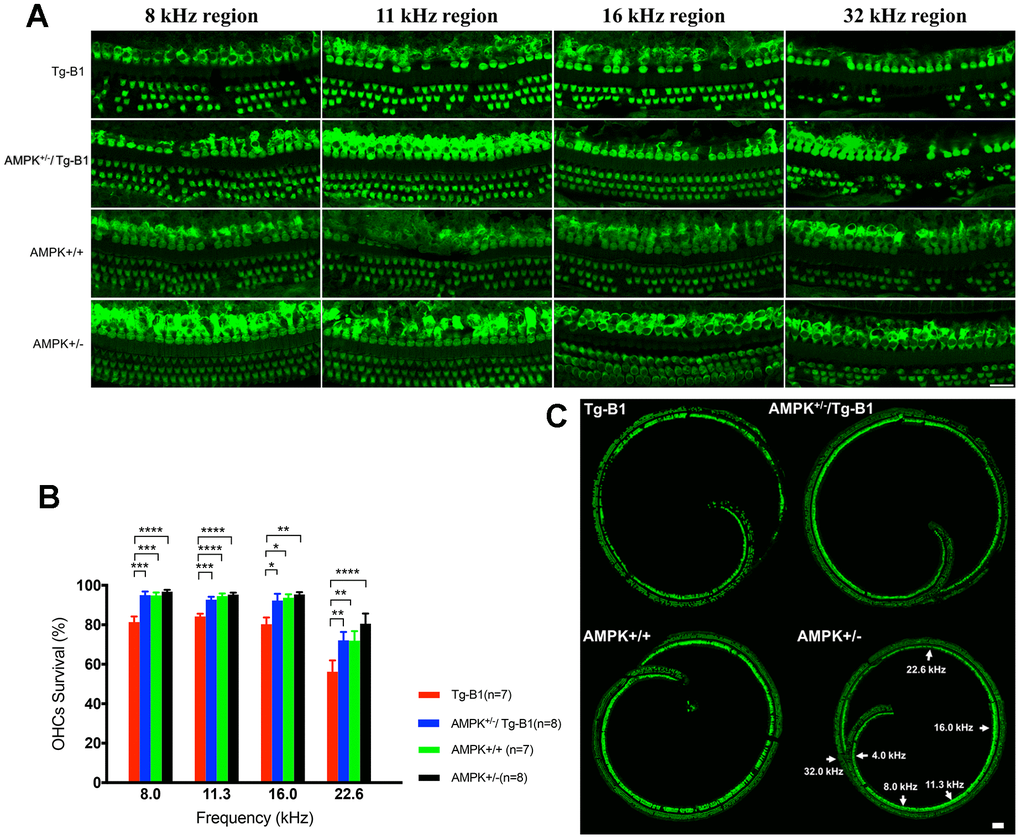 AMPK KO protects OHCs from damages and losses. (A) Representative immunofluorescent surface preparation images of OHCs from four genotype mice aged 10-12 months were captured at the frequency-specific regions (8, 11.3, 16, and 32 kHz) of the cochleae. The OC was dissected for the staining of hair cells with Myosin7a (green). Scale bar=20 μm. (B) Quantification of OHCs survivals in four genotype mice aged 10-12 months. AMPK knockouts increased the number of surviving OHCs in cochlea, differed significantly between Tg-B1 (red bars) and AMPK+/−/Tg-B1 (blue bars) mice at 8, 11.3, 16 and 22.6 kHz regions. Values are presented as mean ± SEM and evaluated with two-way ANOVA followed by Bonferroni post-test. (* PC) Representative confocal microscopy images from four genotypes of the cochleae. For reference, frequency regions of interest were indicated by the arrowheads. Scale bar=50 μm.