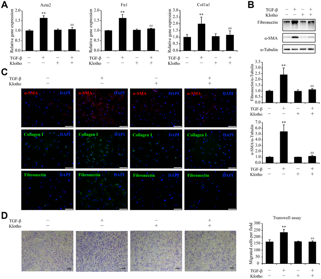 Kl markedly ameliorates pulmonary fibrosis in an ex vivo model. Primary pulmonary fibroblasts isolated from wild type C57BL/6 mice were pre-incubated with or without mouse rKL. After 12 h, they were randomized to be incubated with or without TGF-β and KL for another 24 h when mRNA levels of Acta2, Fn1, and Col1a1 were assessed by qPCR (A), protein levels of fibronectin, α-SMA, and α-Tubulin were examined by western blotting (B), fibronectin, α-SMA, and collagen I were stained by immunofluorescence staining (C), and migration of pulmonary fibroblasts were analyzed by transwell assay (D). Scale bars = 100 μm. **P vs. without TGF-β and without rKL. ##P vs. with TGF-β and without rKL.