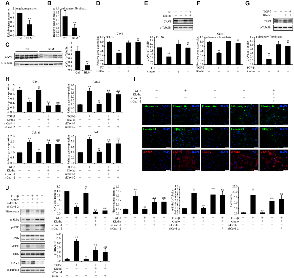 The mitigation of TGF-β-induced pulmonary fibroblasts activation and ECM production by Kl is partially suspended after Cav1 being silenced. mRNA levels of Cav1 were measured by qPCR in the total lung lysates (A) and isolated pulmonary fibroblasts (B) from mice 21 days after intratracheally administering a single dose of PBS (Ctrl) or bleomycin (BLM). Protein levels of CAV1 (C) were examined by western blotting in the total lung lysates from mice 21 days administering a single dose of PBS (Ctrl) or bleomycin (BLM). **P vs. Ctrl. 5-7 animals per group. Mouse PCLSs pre-incubated with or without mouse rKL for 24 h were randomized to be treated with control cocktail (CC) or fibrosis cocktail (FC) with or without rKL for another 48 h, when mRNA (D) and protein (E) levels of Cav1 in the mouse PCLSs from each group were measured by qPCR and western blotting, respectively. **P vs. CC without KL. ##P vs. FC without rKL. Primary pulmonary fibroblasts isolated from wild type C57BL/6 mice were pre-incubated with or without mouse rKL. After 12 h, they were randomized to be incubated with or without TGF-β and rKL for another 24 h when mRNA (F) and protein (G) levels of Cav1 were examined by qPCR and western blotting, respectively. **P vs. without TGF-β or KL. ##P vs. with TGF-β and without rKL. Primary pulmonary fibroblasts isolated from wild type C57BL/6 mice were transfected with control siRNA (siNC) or Cav1 siRNAs (siCav1-1 and -2). After siRNA transfection for 24 h, fibroblasts were pre-incubated with or without mouse rKL for 12 h, followed by treatment with or without TGF-β and rKL for another 24 h, when mRNA levels of Cav1, Acta2, Fn1, and Col1a1 were assessed by qPCR (H), fibronectin, α-SMA, and collagen I were stained by immunofluorescence staining (I, Scale bars = 100 μm), and protein levels of fibronectin, α-SMA, p-JNK, JNK, p-ERK, ERK, CAV1 and α-Tubulin were examined by western blotting (J). **P vs. siNC without TGF-β or rKL. ##P vs. siNC with TGF-β and without rKL. &&P vs. siNC with TGF-β and rKL.