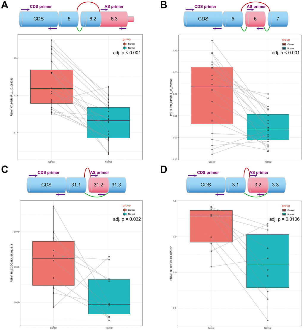 OS-related DEAS events expression in NSCLC. (A) The top plot demonstrated the splicing pattern of AT〇HNRNPLL〇ID〇053259. The bottom plot displays the PSI of AT〇HNRNPLL in cancer and normal tissues. (B) The top plot demonstrated the splicing pattern of ES〇HPCAL1〇ID〇052659. The bottom plot displays the PSI of ES〇HPCAL1 in cancer and normal tissues. (C) The top plot demonstrated the splicing pattern of RI〇CCDC88A〇ID〇053613. The bottom plot displays the PSI of RI〇CCDC88A in cancer and normal tissues. (D) The top plot demonstrated the splicing pattern of RI〇RPL29〇ID〇065167. The bottom plot displays the PSI of RI〇RPL29 in cancer and normal tissues. In the schematic diagram, green lines represent transcripts before splicing and the red lines represent transcripts after splicing.