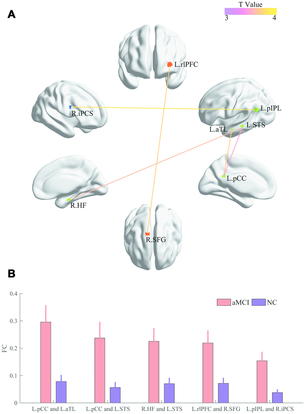 Comparisons of pairwise FC. (A) The colored line indicates the T values. (B) The bar graph displays statistical differences (FDR corrected) in FC between the two groups.