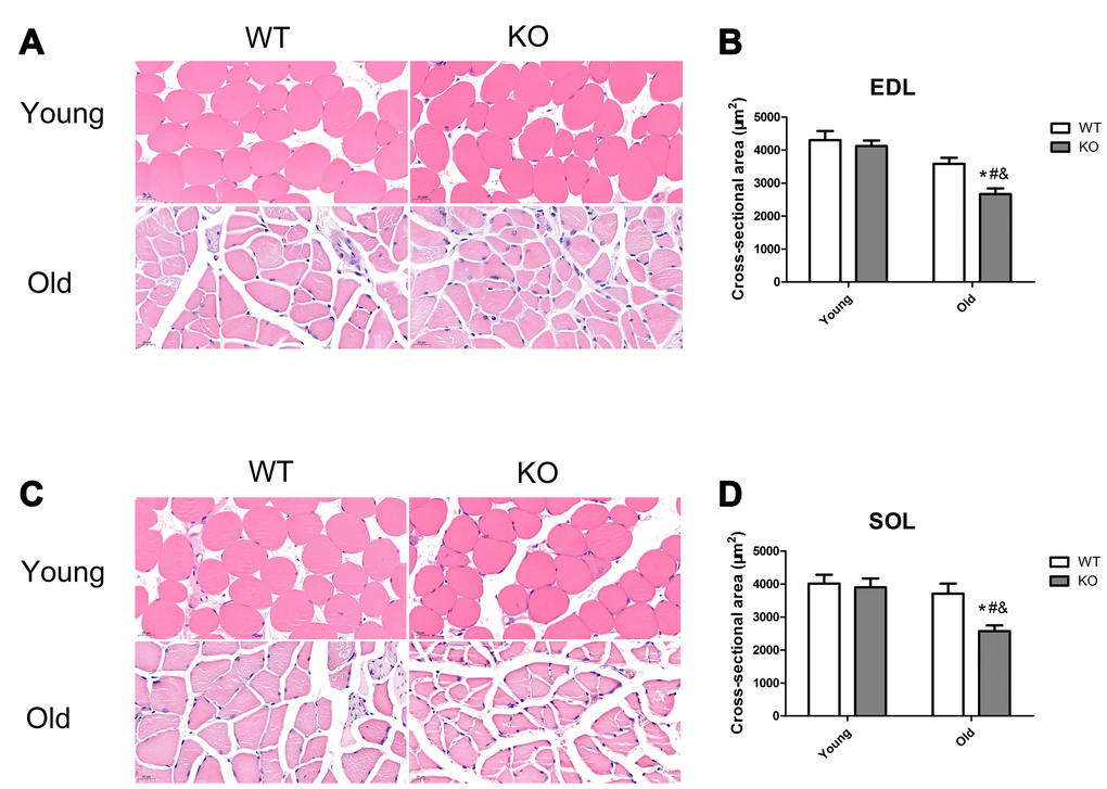 Nrf2 deficiency exacerbated skeletal muscle loss during aging. (A, C) Representative images of the cross-sectional area (CSA) of extensor digitorum longus (EDL) and soleus (SOL) muscles by HE staining. (B, D) CSA of the EDL and SOL muscles in the young and old mice of WT and KO genotypes. Data represent mean ± SE, n=3. #P 