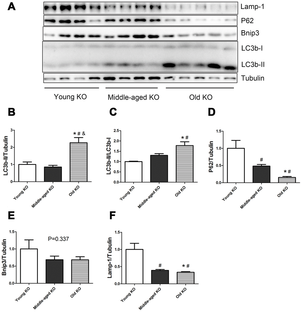 Expression of LC3b-II, LC3b-I, P62, Bnip3, and Lamp-1 proteins in young KO, middle-aged KO, and old KO mice. (A) Western blot images. (B–F) Statistical graphs. Data represent mean ± SE, (n=4-5). *P 