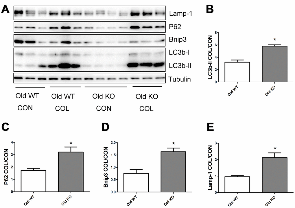 Autophagy flux in skeletal muscle of old WT and old KO mice. (A) Western blot images. (B–E) Statistical graphs. Data represent mean ± SE, n=3-4. *statistically significant.