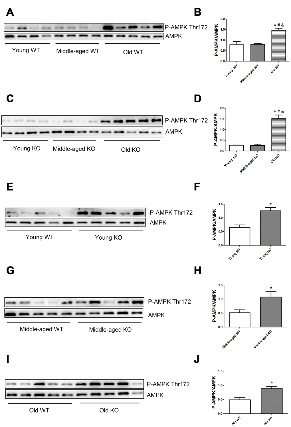 AMPK phosphorylation level in skeletal muscle of different groups. (A, C, E, G, I) Western blot images. (B, D, F, H, J) Statistical graphs. Data represent mean ± SE, n=4-5. *P 