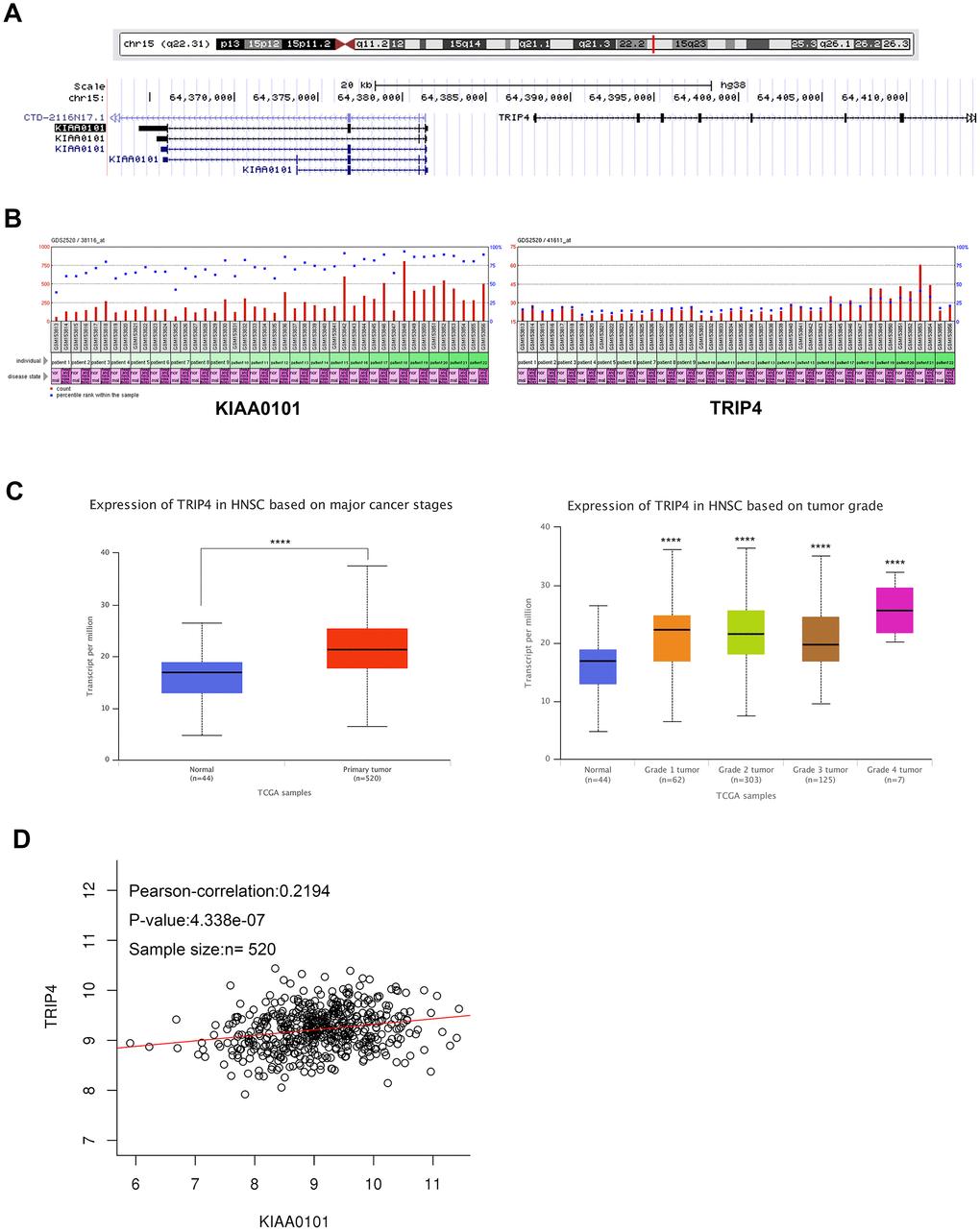 Neighboring gene TRIP4 shows correlated co-expression pattern with KIAA0101 in HNSC. (A) Chromosomal locations of human KIAA0101 and its neighbour gene TRIP4. (B) KIAA0101 has similar expression profiles with TRIP4 in GDS2520 HNSC samples. (C) TRIP4 expression and its association with tumour grade in HNSC were analysed by UALCAN. (D) Correlated expressions between TRIP4 and KIAA0101 in TCGA HNSC samples, ****p