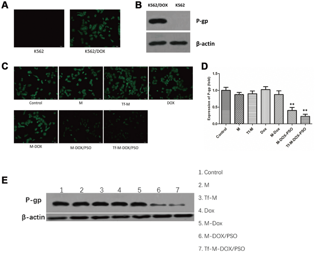 Targeted delivery system inhibition of P-gp expression levels. (A) The expression levels of P-gp in K562 cells and K562/DOX cells analyzed by fluorescence microscopy and (B) immunoblotting. The effects of various drug delivery system formulations on the delivery system were examined by (C) fluorescence microscopy (D) RT-PCR and (E) immunoblotting. Data are shown as mean ± standard deviations (n=3).