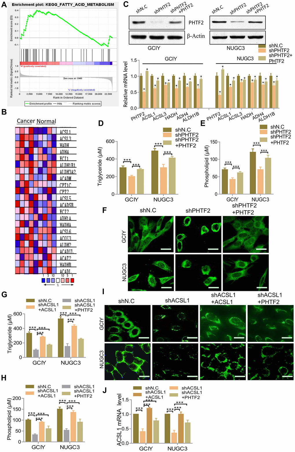 Effects of PHTF2 on the intracellular contents of lipids and key lipid metabolic enzymes in gastric cancer cells. (A) Identification of gene sets enriched in phenotypes correlated with PHTF2 by GSEA using TCGA data. (B) Heat map of core enrichment genes in the gene set KEGG FATTY ACID METABOLISM. (C) Up: Western blot showed PHTF2 protein expression in indicated cells. Down: RT-qPCR analysis for mRNA levels of the key lipid metabolic enzymes ACSL2, ACSL3, HADH, ADH4 and ALDH1B in the indicated cells. (D, E) Cellular content of triglycerides (D) and phospholipids (E) was detected in the indicated cells. (F) The neutral lipids content was detected by double staining with BODIPY 493/503 dye in the indicated cells. Scale bars (10 μm). (G, H) Cellular content of triglycerides (G) and phospholipids (H) was detected in the indicated cells. (I) The neutral lipids content was detected by double staining with BODIPY 493/503 dye in the indicated cells. Scale bars (10 μm). (J) RT-qPCR analysis for ACSL1 mRNA levels in the indicated cells.