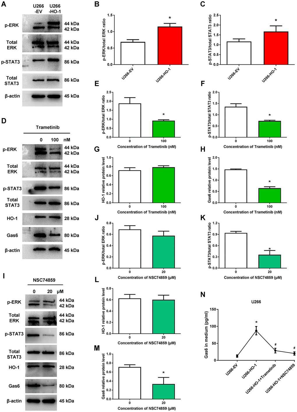 CAMKIIγ is a targetable driver of multiple myeloma through CaMKIIγ