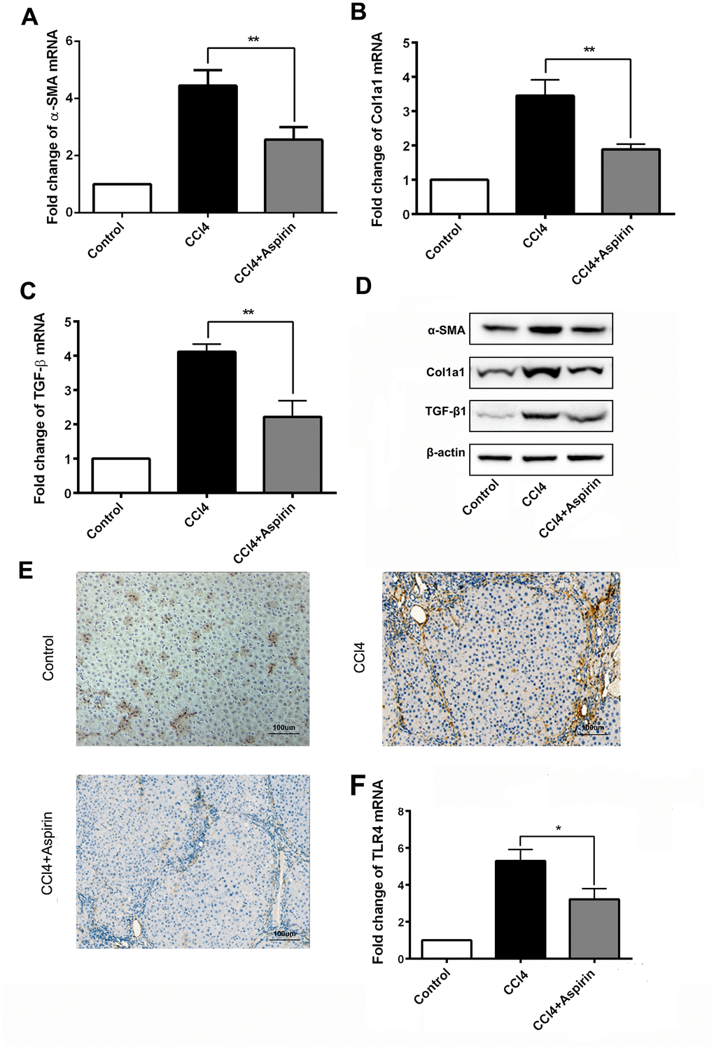 Aspirin reduces expression of profibrogenic associated mediators and TLR4. (A–C) mRNA expression of early markers of fibrogenesis including α-SMA, collagen-a1 and TGF-β1 was detected by real-time PCR. (D) Western blot was employed to detect the expression ofα-SMA, collagen-a1 and TGF-β1 in liver tissues. (E, F) TLR4 expression was tested by real-time PCR and immunochemistry analysis. (×200; scale bar: 100μm) *P**P